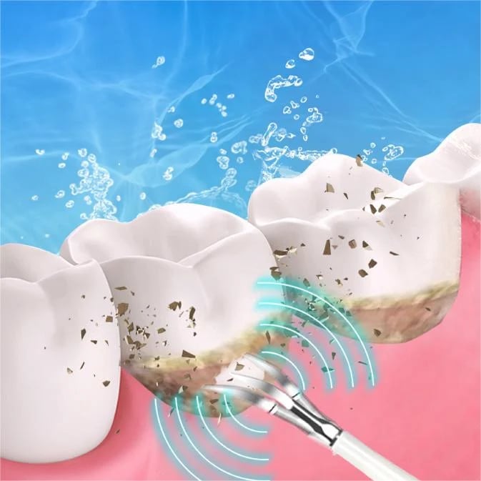 👨‍⚕Electric tooth cleaning instrument